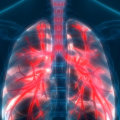 How early can you detect mesothelioma?
